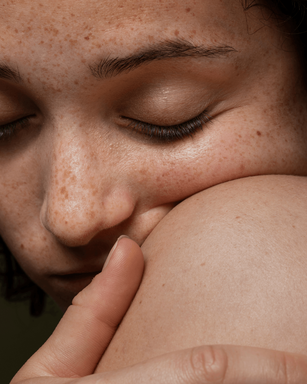 hormunity-hyperpigmentation-protocol-image
